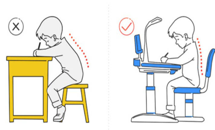 Ngồi sai tư thế làm biến dạng cấu trúc xương